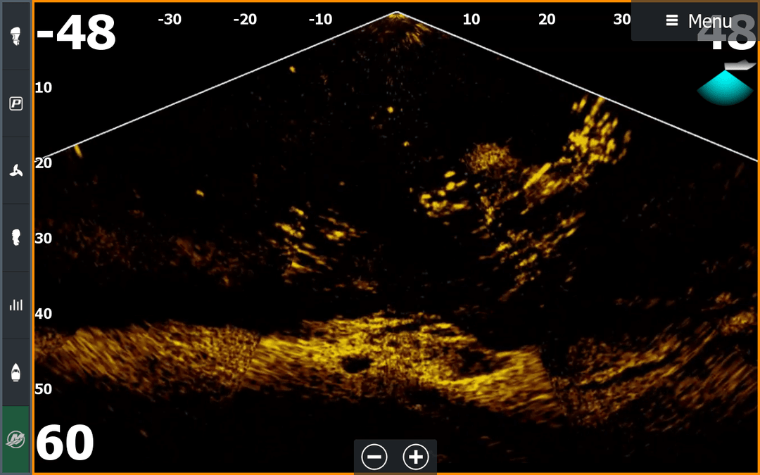 Cardiac ultrasound image showing dynamic echocardiographic data with color Doppler visualization of heart tissue and blood flow patterns.